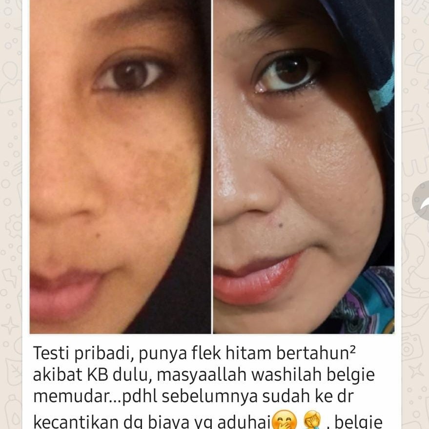 Facial Wash Belgie Pro